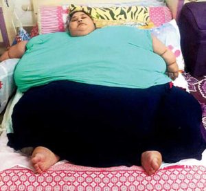 Worlds Heaviest Woman Eman Ahmed Loses Over 100 kg In 3 Weeks Through ...