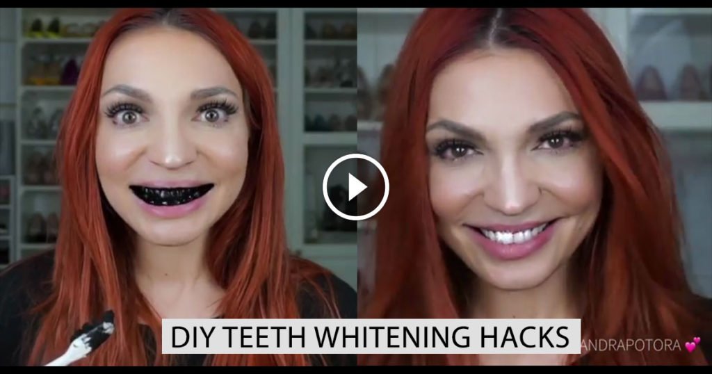 Diy Teeth Whitening Hacks Home Remedies For Natural White Teeth 9005