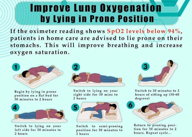 Improve Oxygen Level: Prone Position For Covid Patients